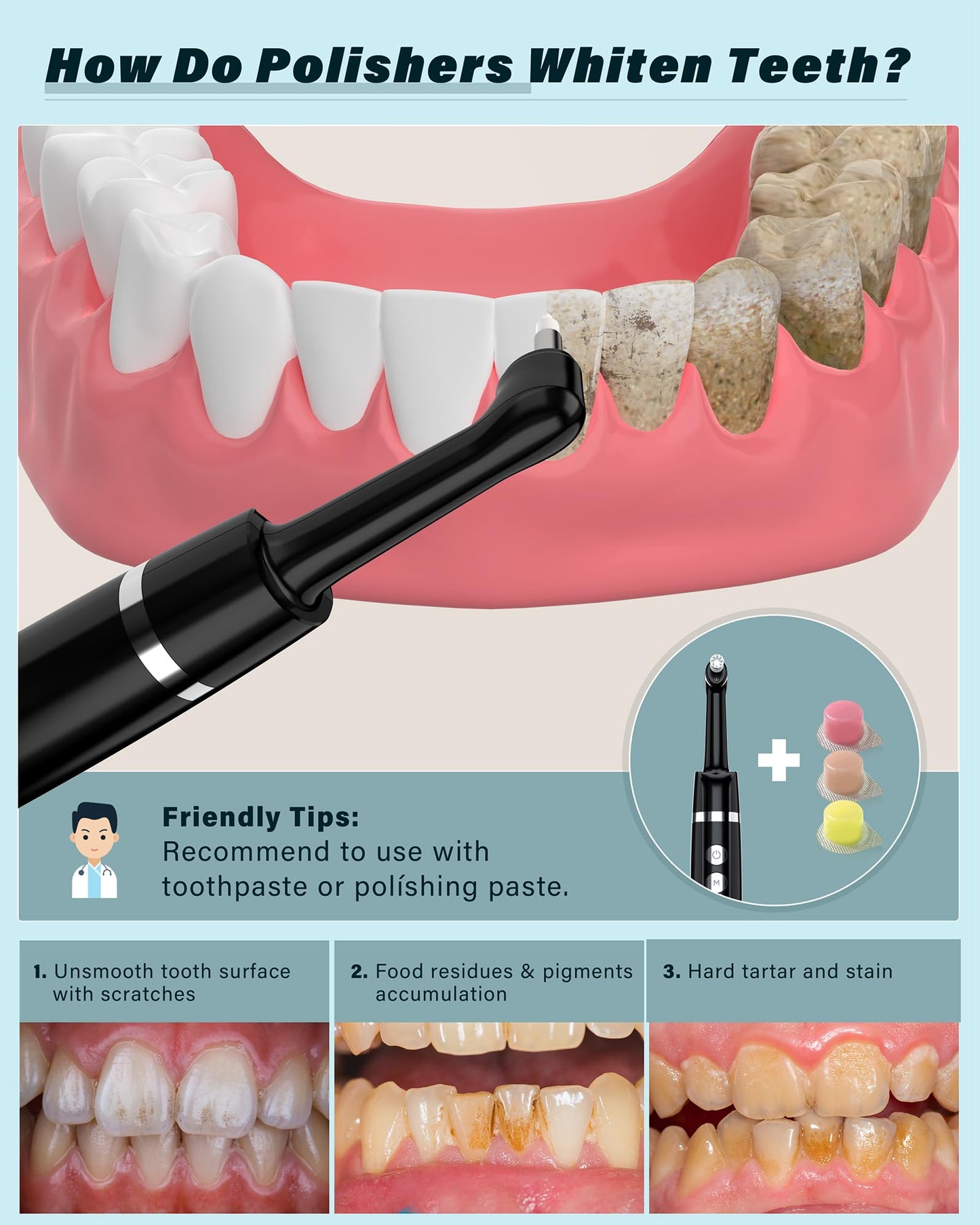 Tooth Polisher, Rechargeable Tooth Whitening Kit for Teeth Cleaning and Whitening, with 3 Tooth Polish Paste and 5 Brush Heads, LED Light, Easy to Use at-Home Personal Dental Care Kit (Black)