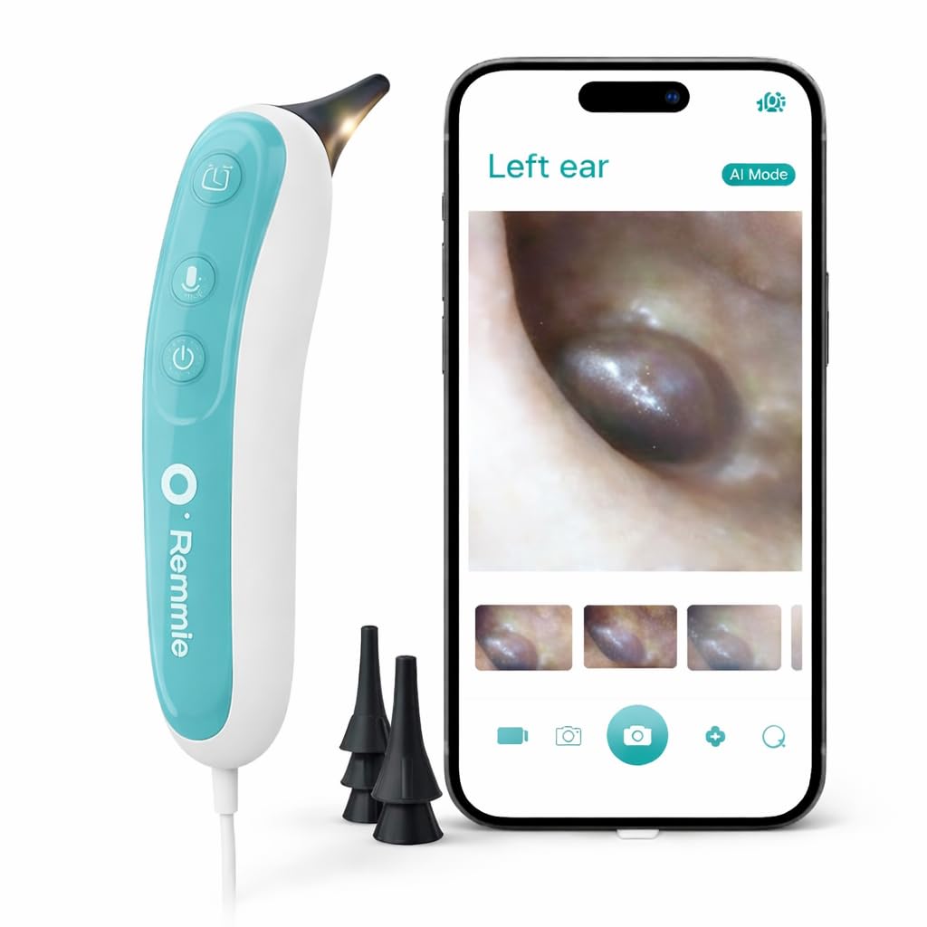 Remmie 4 AI-Powered Digital Otoscope with Light for Home Use - Ear Infection Checker for Kids & Adults - Nose Scope Video Camera with Telemedicine-Enabled App - FDA-Registered