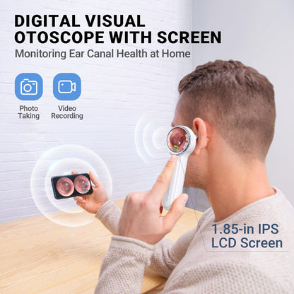 ScopeAround Otoscope, 720PHD Ear Scope Set, Digital Otoscope w/1.85in IPS Screen, Ear Wax Removal Tool Camera, Video Otoscope Ear Camera with 6 LED Lights, Compatible with Android/iPhone