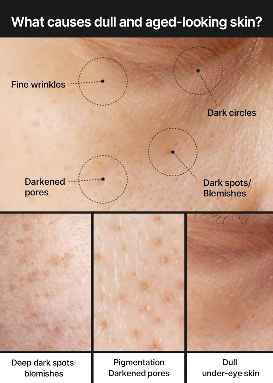 celimax Pore+Dark Spot Brightening Cream | with Niacinamide, Tranexamic Acid, TXA Cream, Pore Minimizer, Non-Irritating, Hydrating, For Sensitive Skin, 35ml